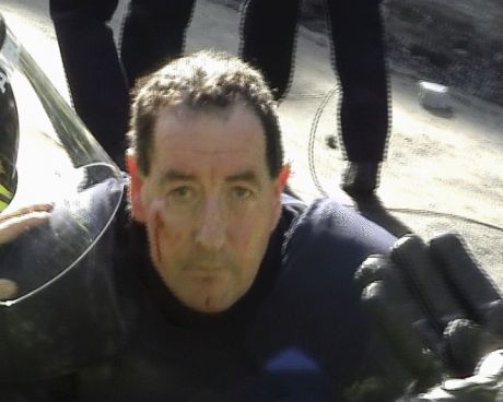 Injured Garda