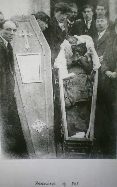 Click on image to see full-sized version The body of Patrick Loughnane after torture by members of the RIC