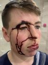 Victim of Garda Brutality